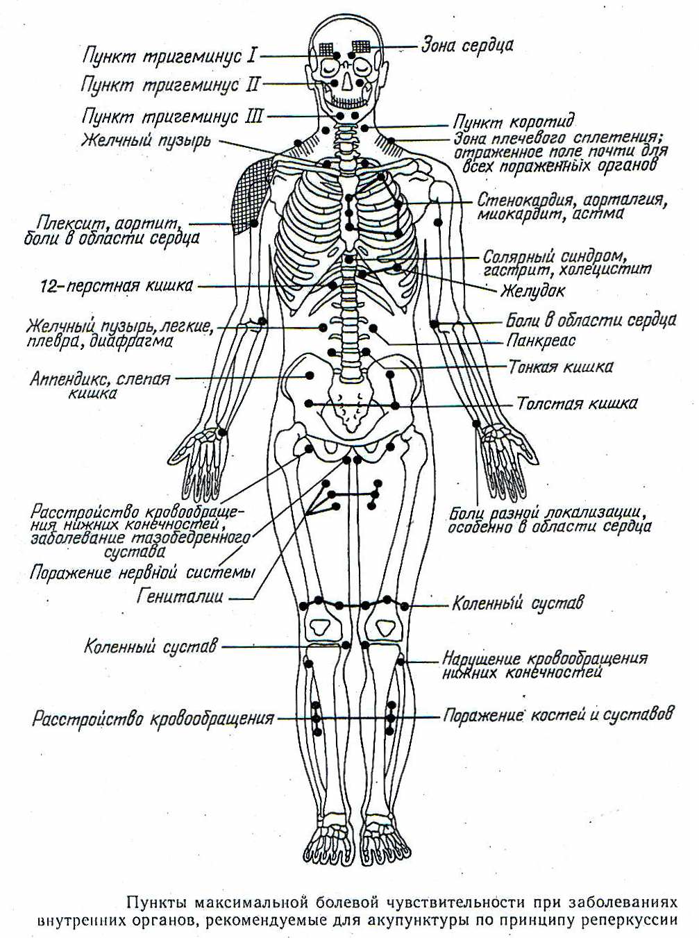 Пункты максимальной болевой чувствителности при заболеваниях внетренних органов, рекомендуемые для акупунктуры по принципу реперкуссии 